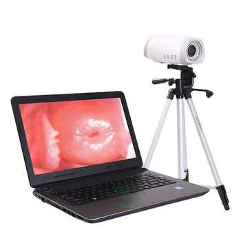 MOJ-F003 medicinske porodništva prenosni mini digital video colposcope za vagina